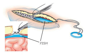 fish-2